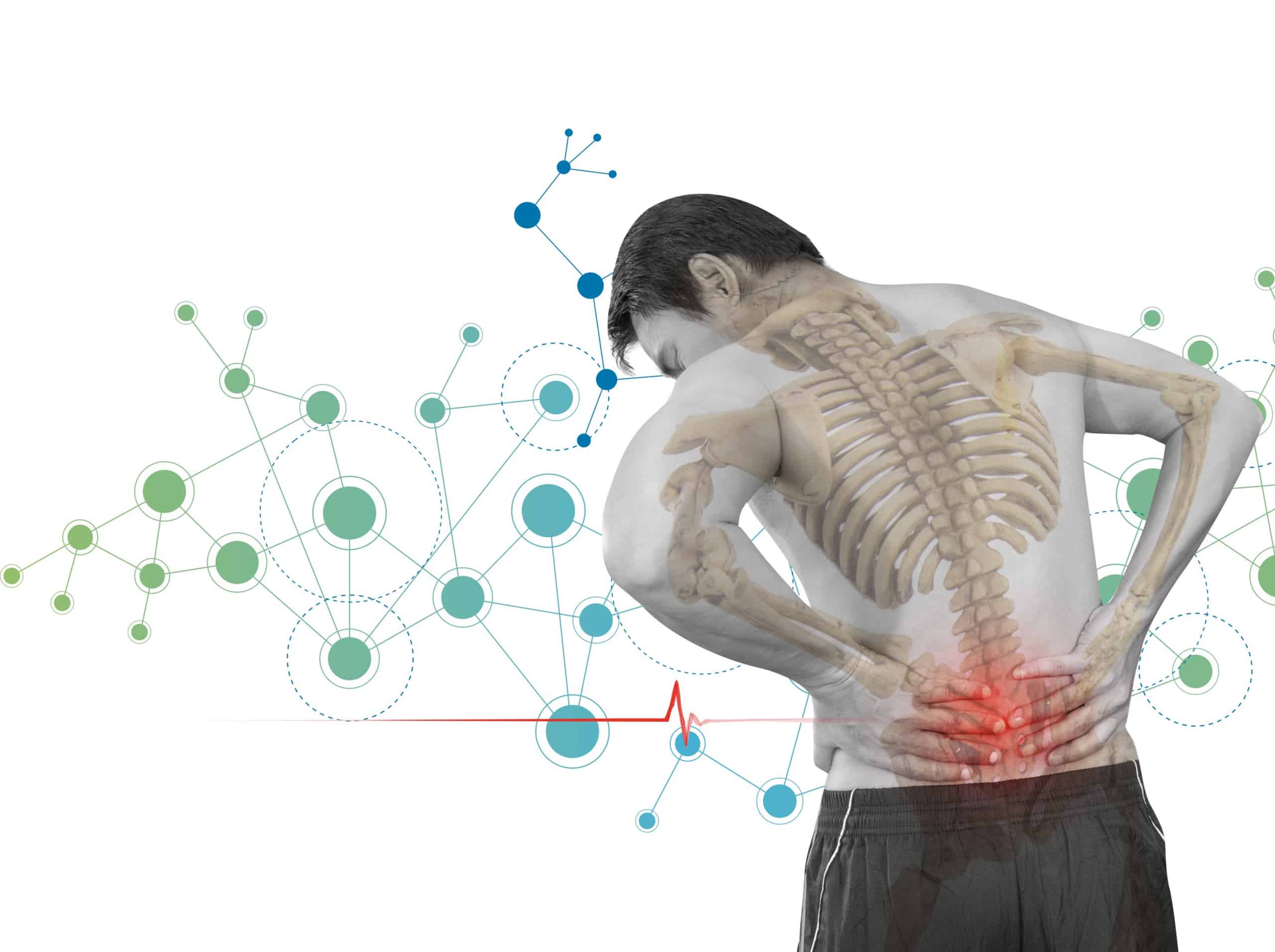 stem cell therapy for back pain in Denver, CO