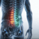 Advanced spinal health with stem cell therapy for pain relief and recovery.